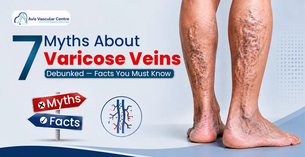 venous-incompetence