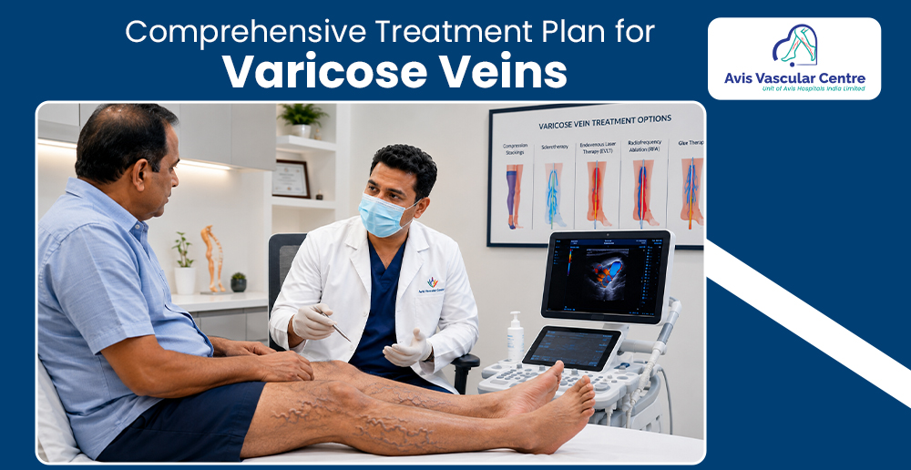 gym varicose veins