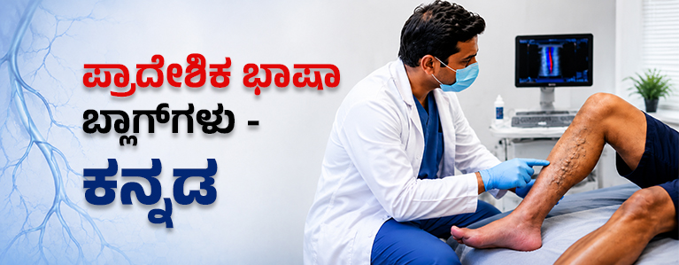 Kannada vascular health and spider veins article