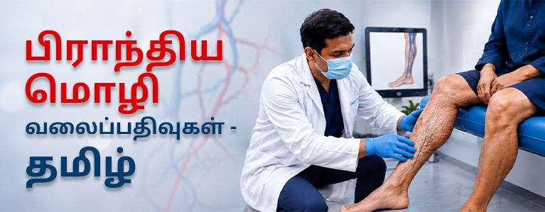 Tamil vascular health and varicose veins article
