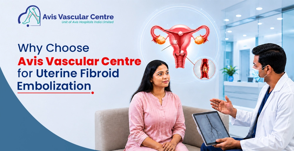 Why-Choose-Avis-Vascular-Centre