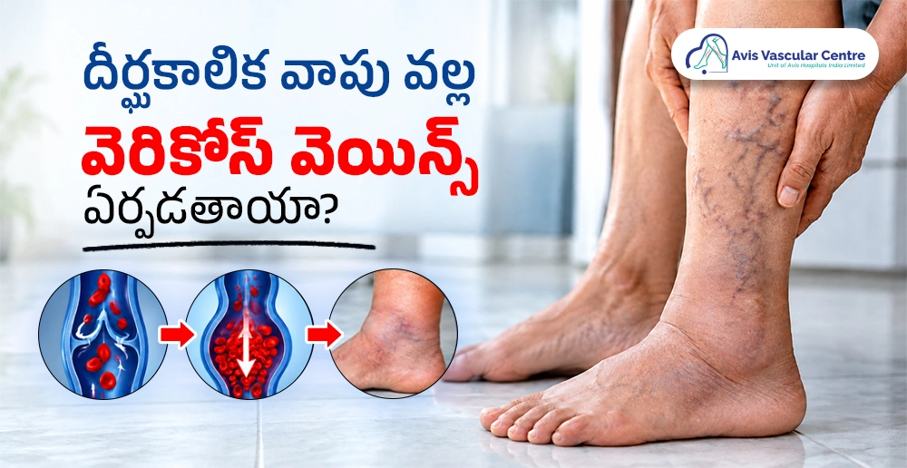 restless-legs-and-varicose-veins-connection