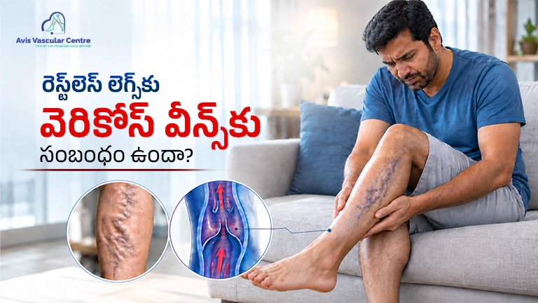 restless-legs-and-varicose-veins-connection