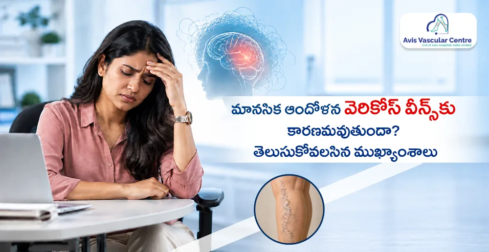 మానసిక-ఆందోళన-వెరికోస్-వీన్స్