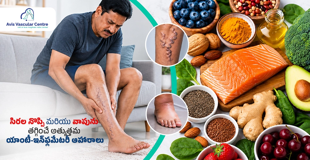 సిరల నొప్పి మరియు వాపును తగ్గించే అత్యుత్తమ యాంటీ-ఇన్‌ఫ్లమేటరీ ఆహారాలు
