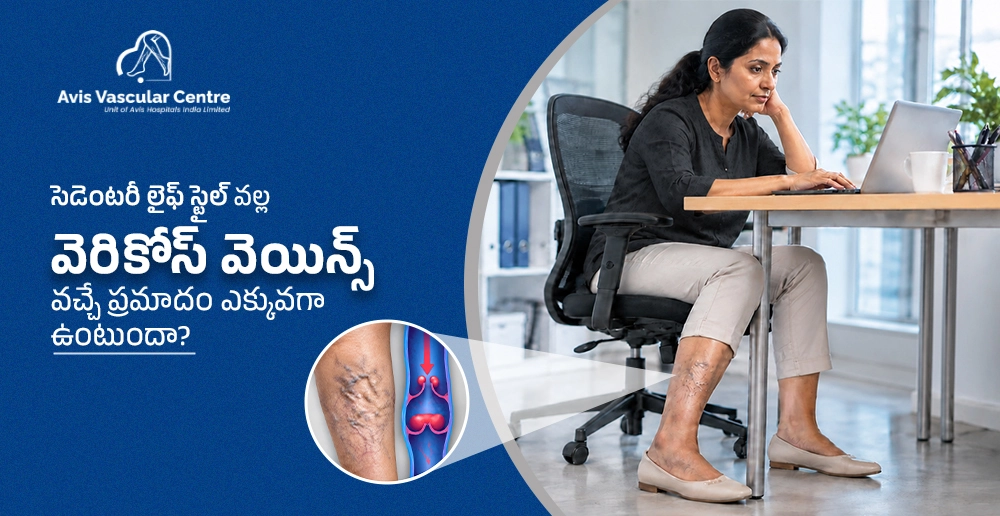 సెడెంటరీ-లైఫ్-స్టైల్-వల్ల-వెరికోస్-వెయిన్స్